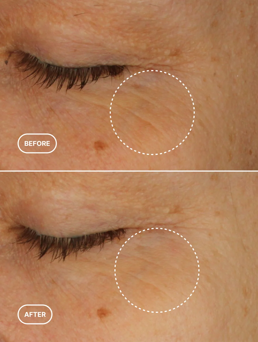 Sérum contour des yeux alternatif au rétinol